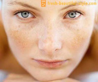 Γιατί φολιδωτό δέρμα στο πρόσωπο; Πρόβλημα δέρμα του προσώπου